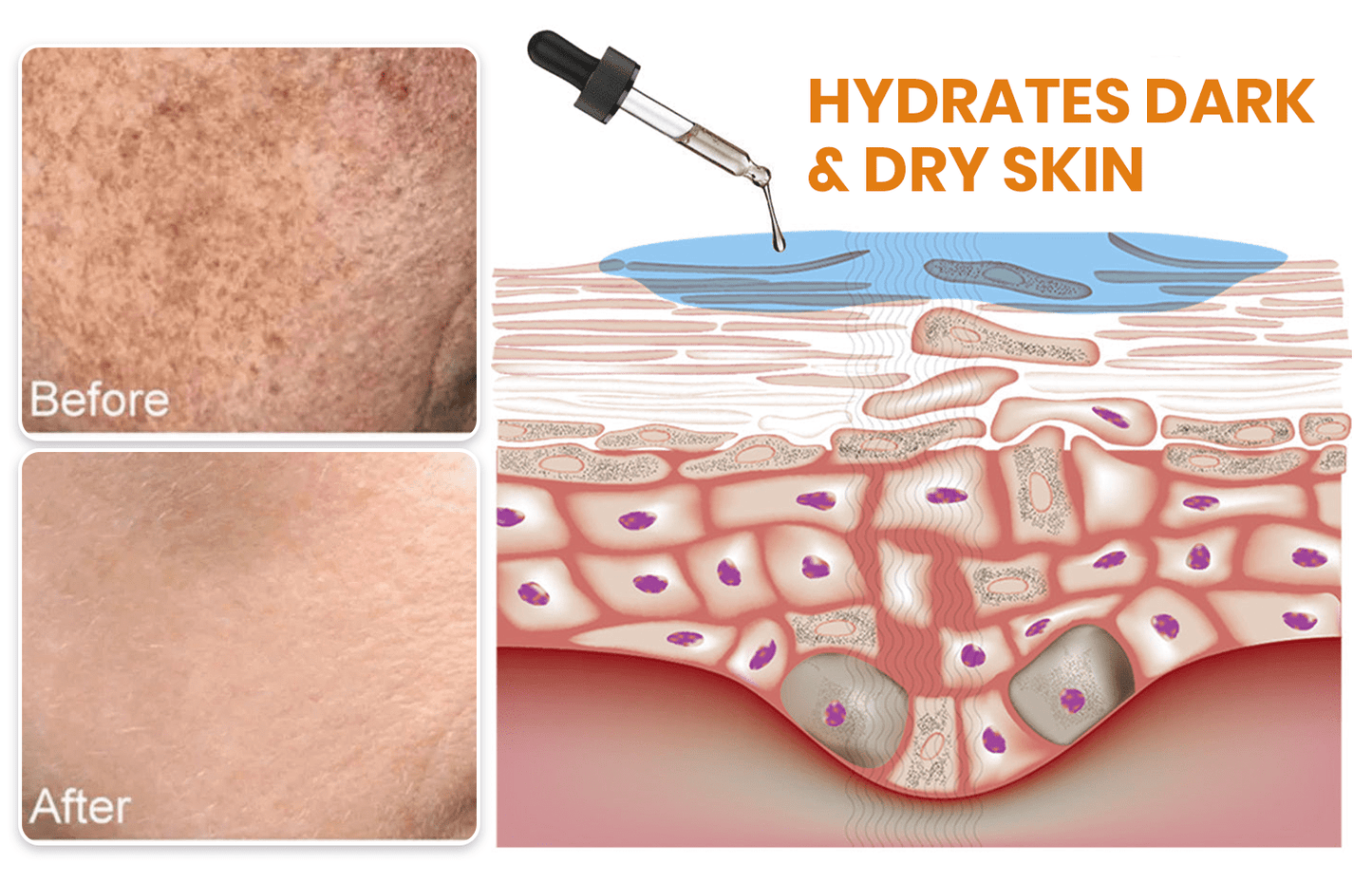 Fast Dark Spot Remover-KISSHI™ Melanin Correcting Facial Serum D02