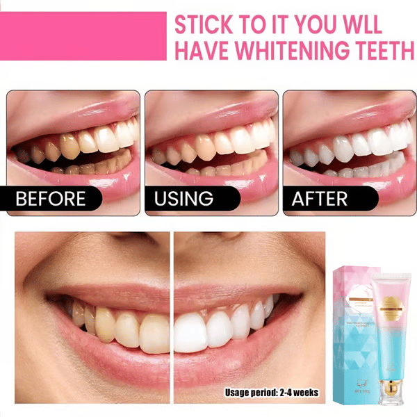 Luhaka® 🔥🎉Buy 2 Get 1 Free-🦷 Niacinamide Whitening Toothpaste D03