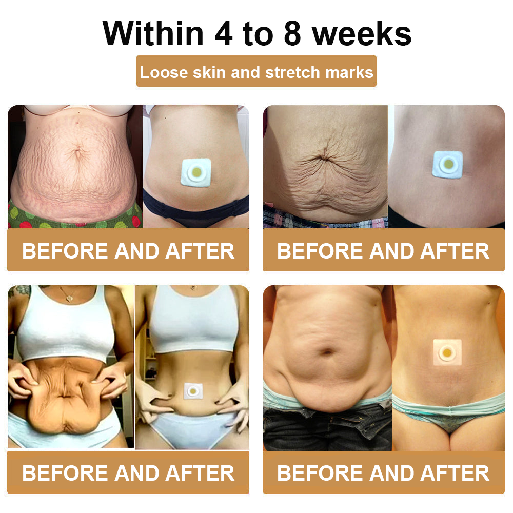 KISSHI™ Bee Venom Lymphatic Drainage Slimming Patch D01