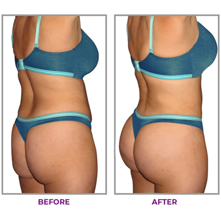 KISSHI™ Hip Plump Capric Oil D01