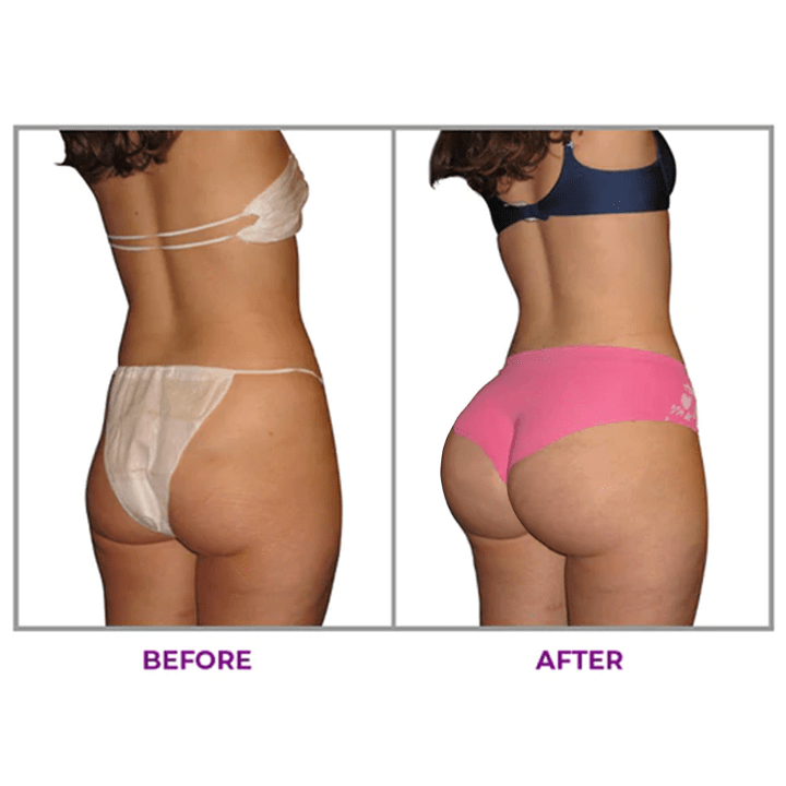 KISSHI™ Hip Plump Capric Oil D01