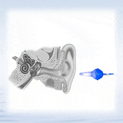 CZTICLE®💥2025 NEW DESIGN-👂The World's First Fluid Inflatable Earplug D02