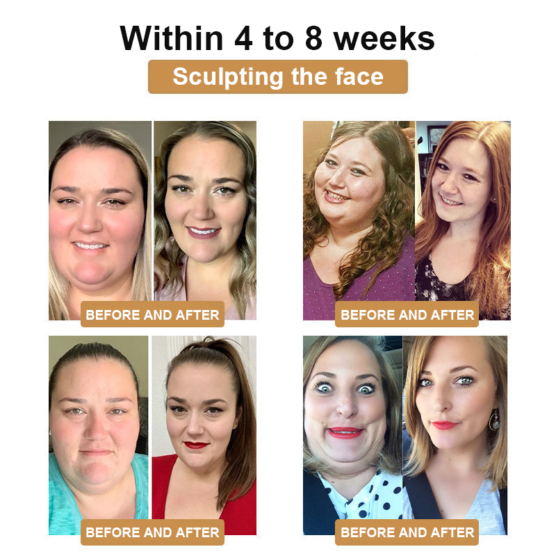 KISSHI™ Bee Venom Lymphatic Drainage Slimming Patch D01