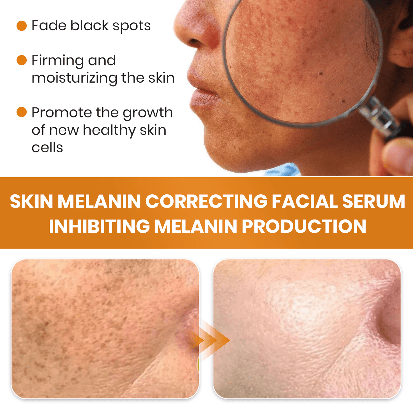 Fast Dark Spot Remover-KISSHI™ Melanin Correcting Facial Serum D02