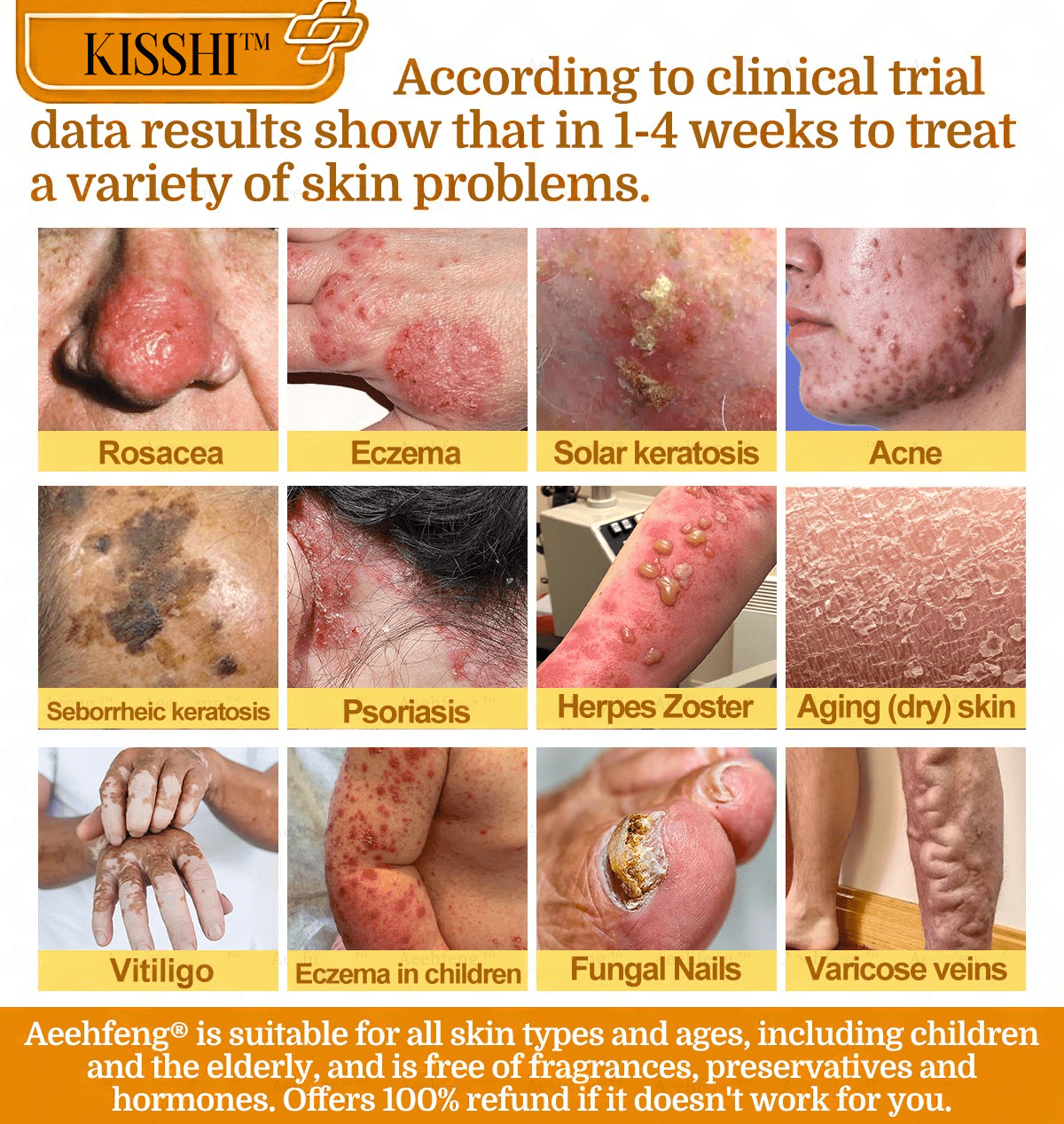 KISSHI™ Bee Venom Skin Salve Ointment Stick D02