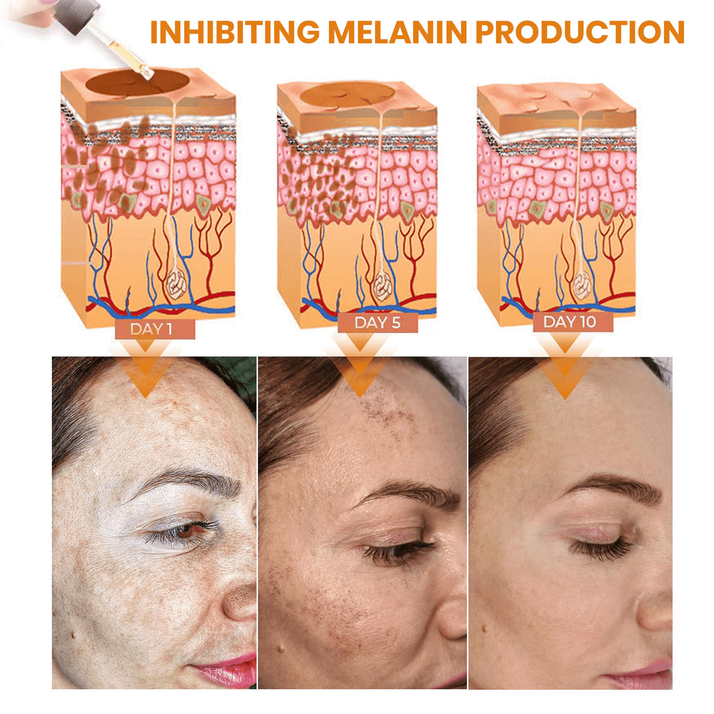 Fast Dark Spot Remover-KISSHI™ Melanin Correcting Facial Serum D02