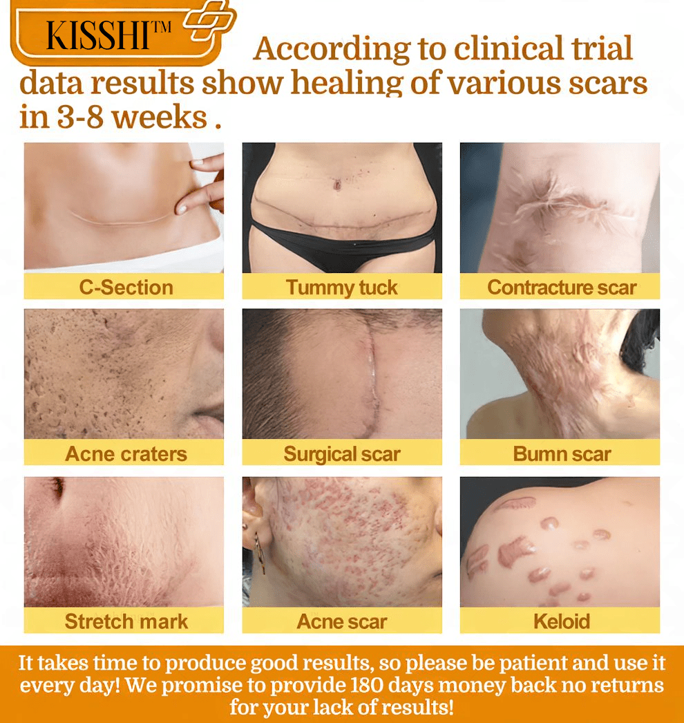 KISSHI™ Bee Venom Skin Salve Ointment Stick D02