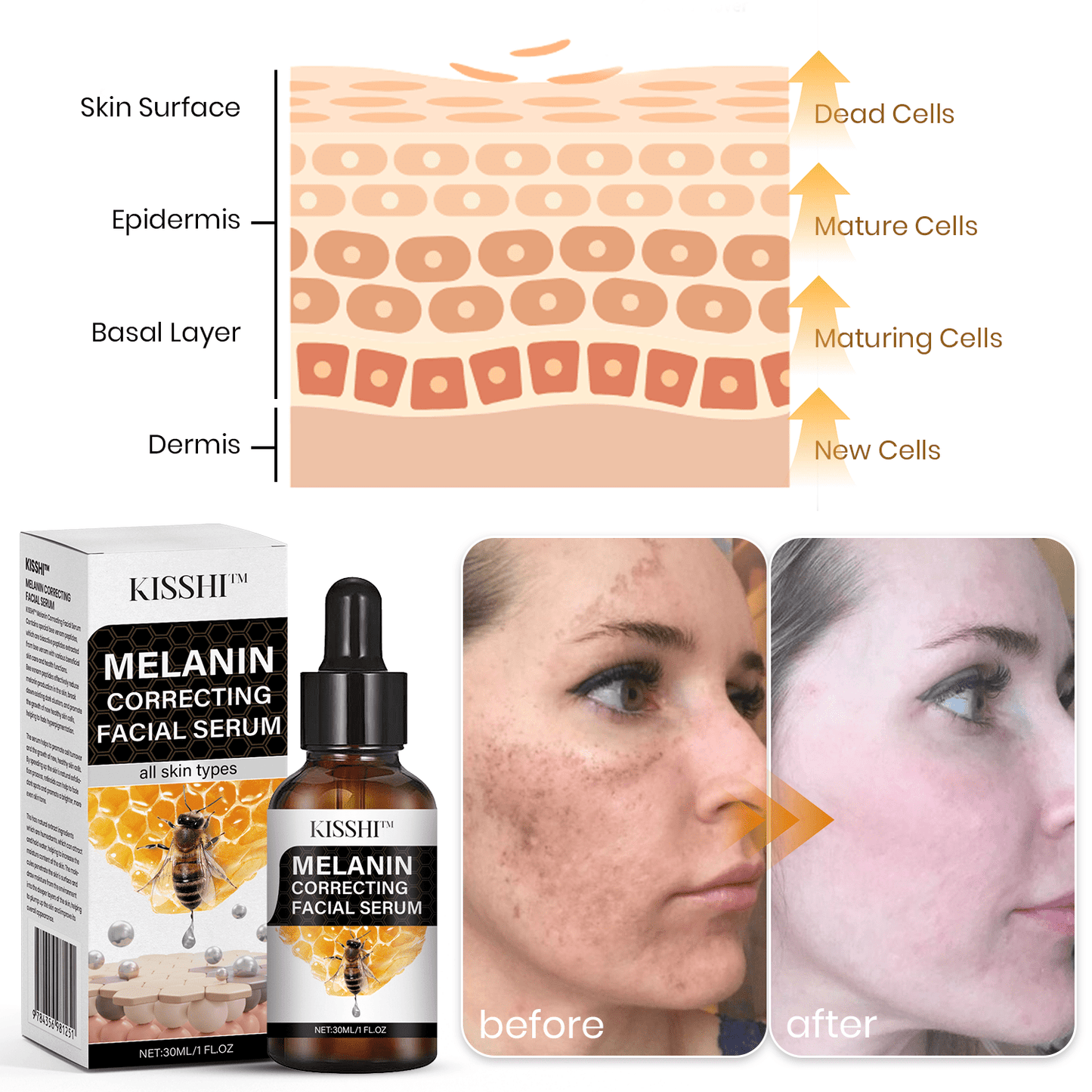 Fast Dark Spot Remover-KISSHI™ Melanin Correcting Facial Serum D02