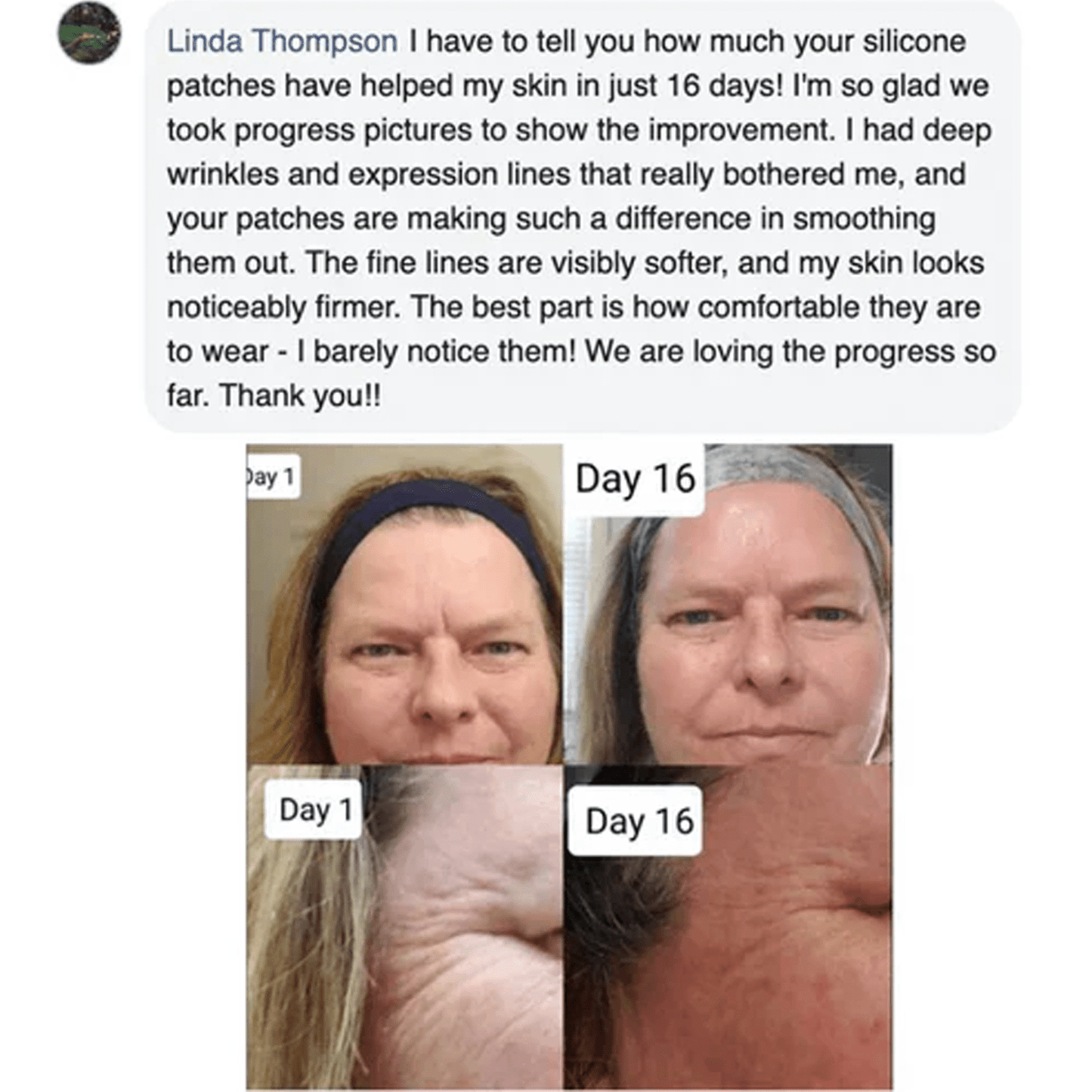 Luhaka™ Silicone Scar & Wrinkle Tape D01