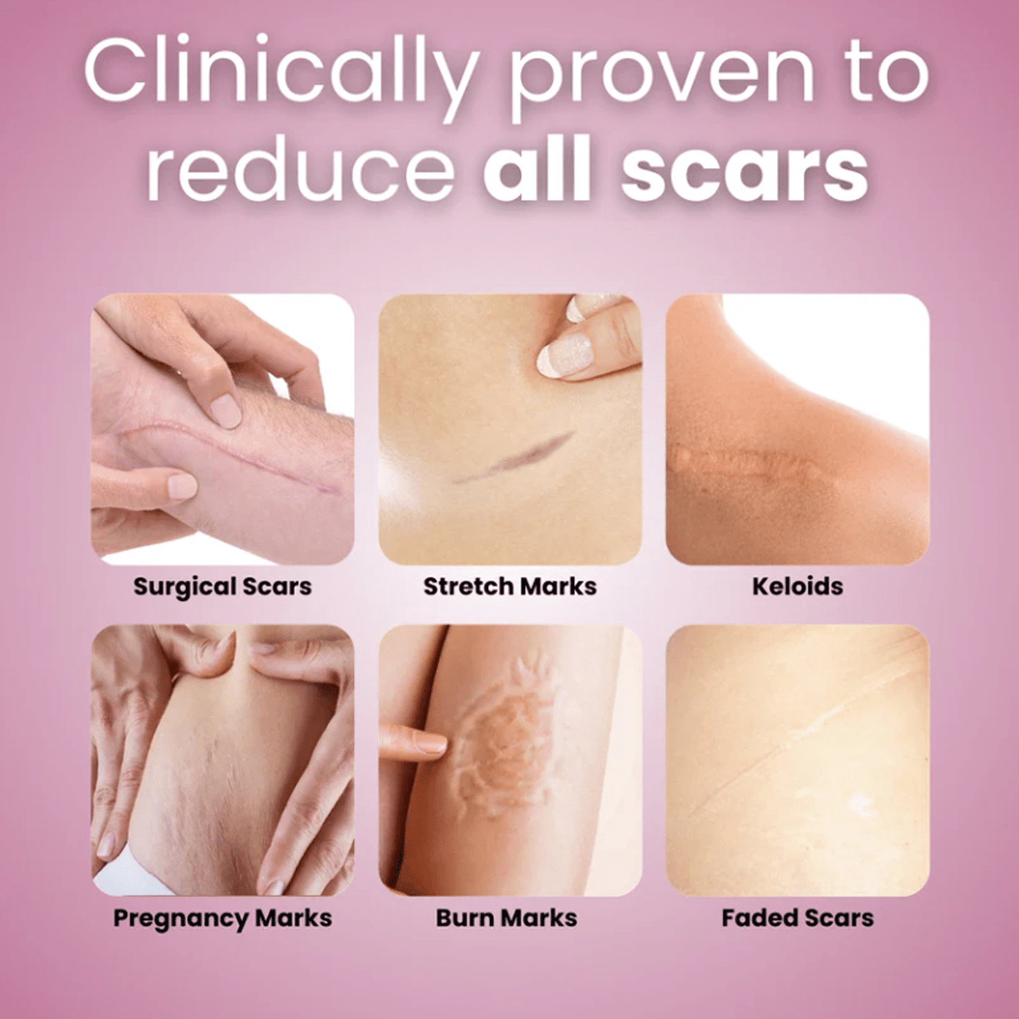 Luhaka™ Silicone Scar & Wrinkle Tape D01