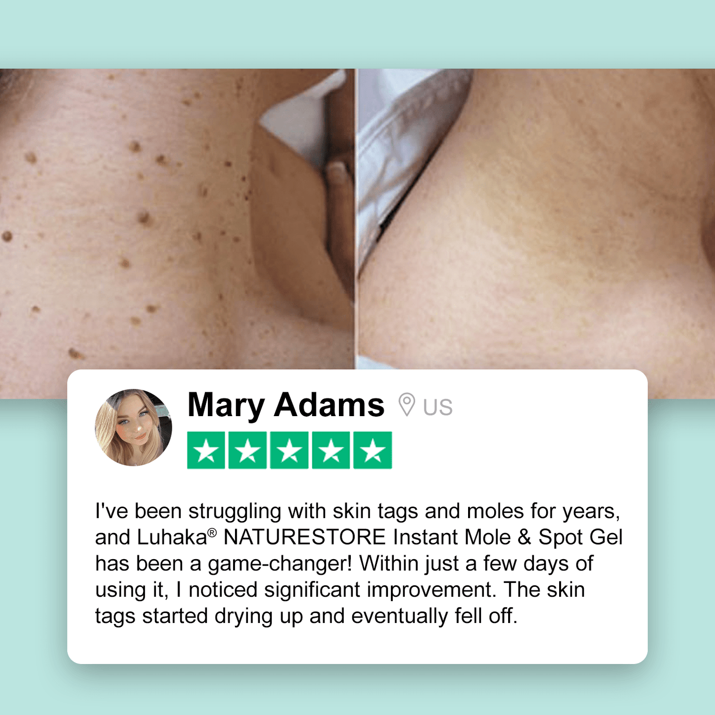Luhaka® NATURESTORE Instant Mole & Spot Gel D03