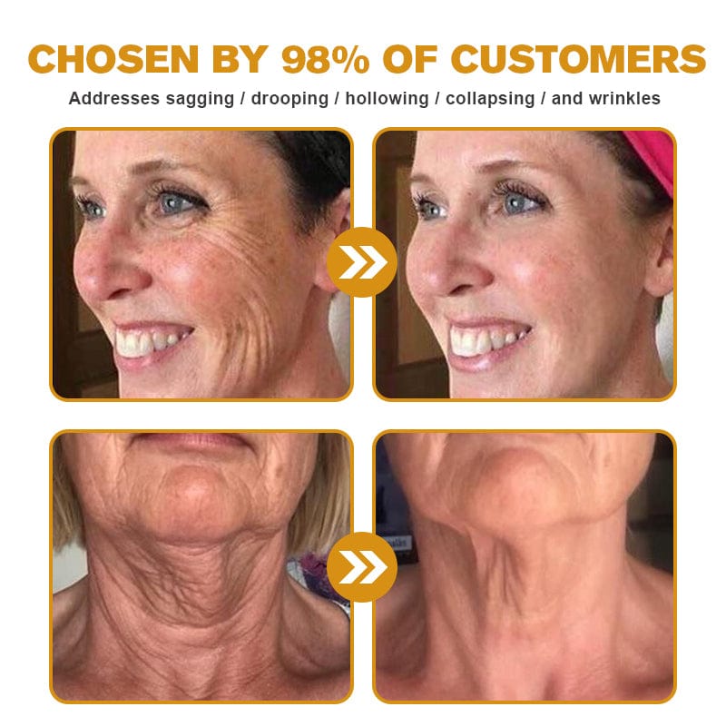 Kisshi™ Botox Bee Venom Wrinkle Removal Cream  D01