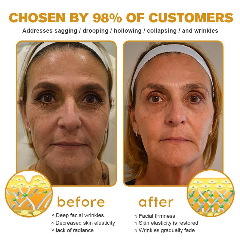 Kisshi™ Botox Bee Venom Wrinkle Removal Cream  D01