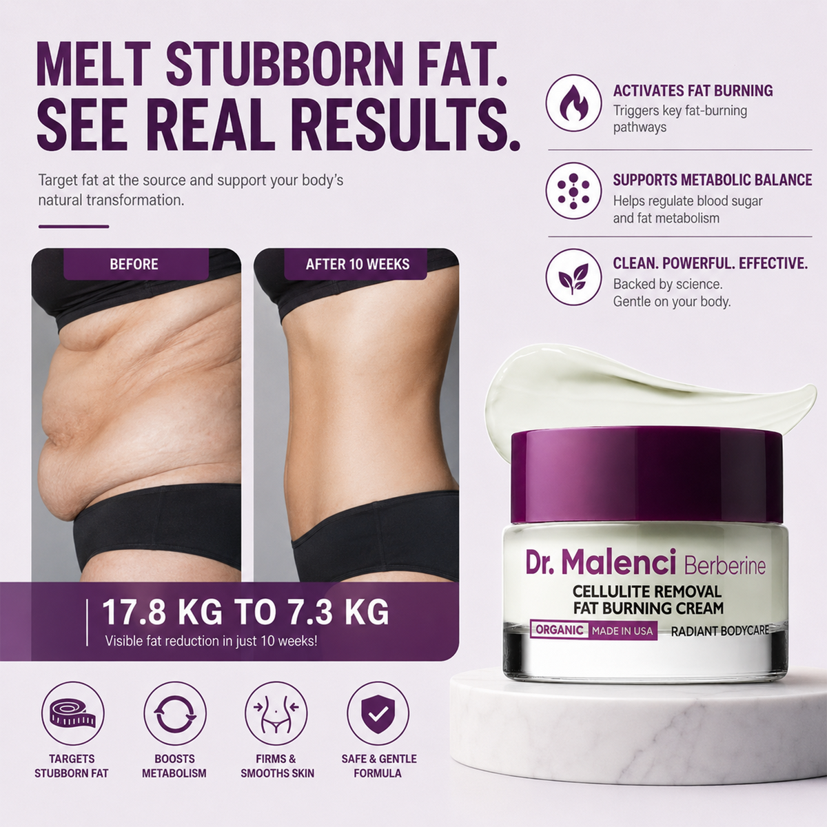 🇺🇸 Official Store | 🌙🌙Dr. Malenci Berberine Cellulite Removal Fat Burning Cream — Smooth, Firm & Sculpt Stubborn-Looking Areas
