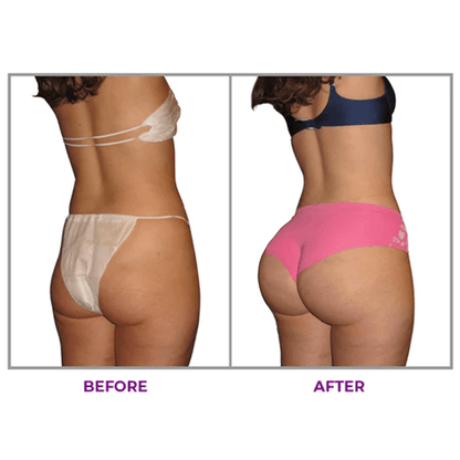 KISSHI™ Hip Plump Capric Oil D02