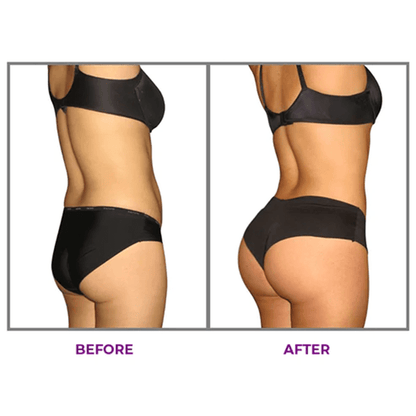 KISSHI™ Hip Plump Capric Oil D02
