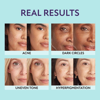 Luhaka® 🔥 All-in-one moisturizer. concealer & coverage✨ D04